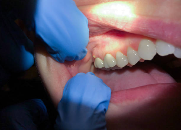 Best Cosmetic Emergency Dentistry in Sugar Creek, MO